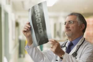 doctor looking at spinal cord injury x-ray
