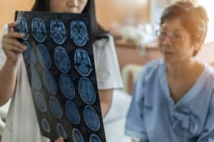 Brain disease diagnosis with medical doctor diagnosing elderly ageing patient